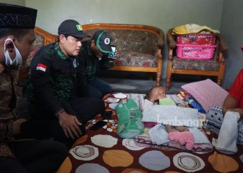 GPK Jombang Berikan Bantuan Bayi 14 Bulan Penderita Hidrosefalus