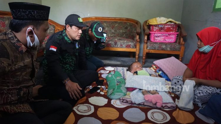 GPK Jombang Berikan Bantuan Bayi 14 Bulan Penderita Hidrosefalus