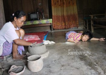 Anak Penjual Gerabah Alami Gangguan Syaraf Otak, Butuh Bantuan